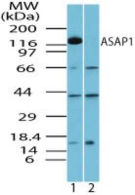 Western Blot: ASAP1 Antibody [NBP2-24643]