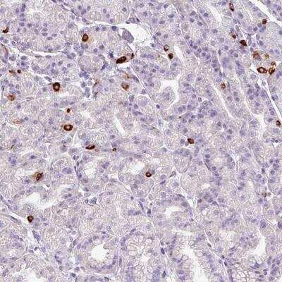 Immunohistochemistry-Paraffin: ASB1 Antibody [NBP1-89009]