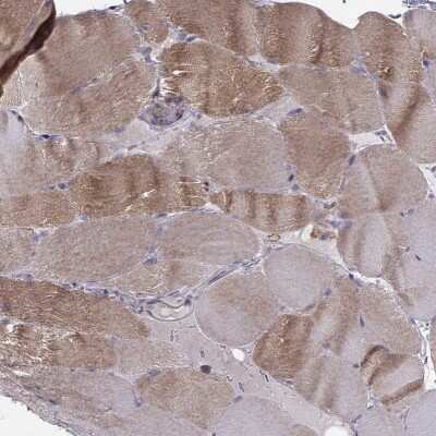 Immunohistochemistry-Paraffin: ASB16 Antibody [NBP2-57575]