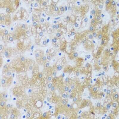 Immunohistochemistry-Paraffin: ASB4 Antibody - Azide and BSA Free [NBP3-04635]