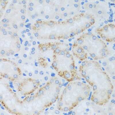 Immunohistochemistry-Paraffin: ASB4 Antibody - Azide and BSA Free [NBP3-04635]