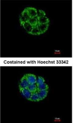 Immunocytochemistry/ Immunofluorescence: ASB5 Antibody [NBP1-32603]