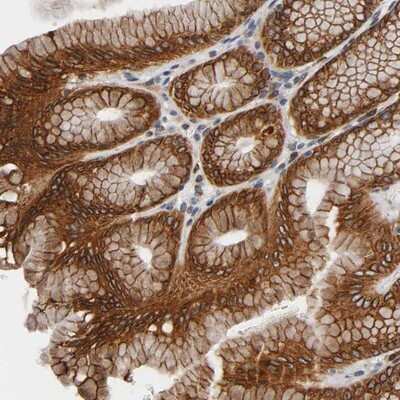 Immunohistochemistry-Paraffin: ASB6 Antibody [NBP1-86141]