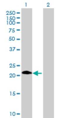 Western Blot: ASB6 Antibody [H00140459-B01P]