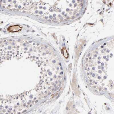 Immunohistochemistry-Paraffin: ASB7 Antibody [NBP1-86157]