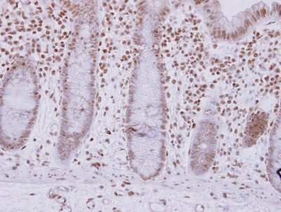 Immunohistochemistry-Paraffin: ASB7 Antibody [NBP2-15483]
