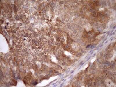 Immunohistochemistry: ASB8 Antibody (OTI3A12) [NBP2-46547]