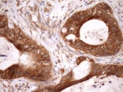 Immunohistochemistry: ASB8 Antibody (OTI3A12) - Azide and BSA Free [NBP2-72400]