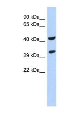 Western Blot: ASB8 Antibody [NBP1-58904]