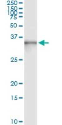 Immunoprecipitation: ASB9 Antibody (1D8) [H00140462-M01]