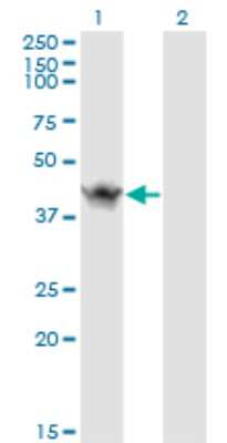 Western Blot: ASB9 Antibody (1D8) [H00140462-M01]