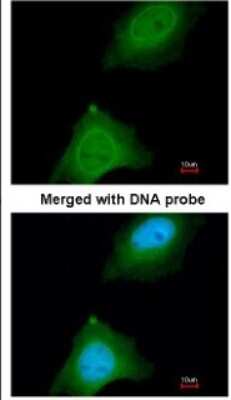 Immunocytochemistry/ Immunofluorescence: ASB9 Antibody [NBP1-32541]