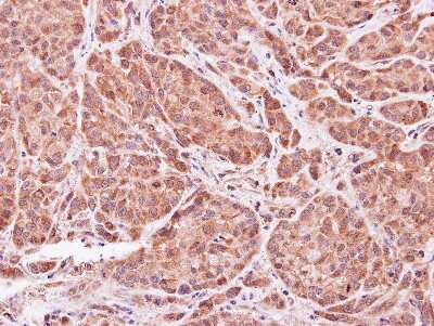 Immunohistochemistry-Paraffin: ASB9 Antibody [NBP1-32541]