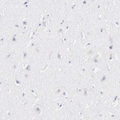 Immunohistochemistry-Paraffin: ASB9 Antibody [NBP1-85081]