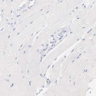 Immunohistochemistry-Paraffin: ASB9 Antibody [NBP1-85081]