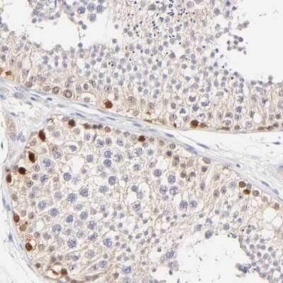 Immunohistochemistry-Paraffin: ASB9 Antibody [NBP1-85081]