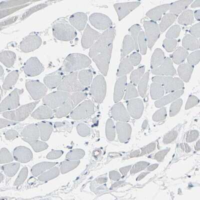 Immunohistochemistry-Paraffin: ASB9 Antibody [NBP1-85082]