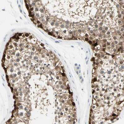 Immunohistochemistry-Paraffin: ASB9 Antibody [NBP1-85082]