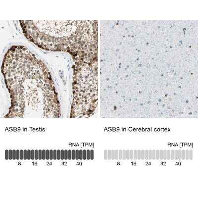 Immunohistochemistry-Paraffin: ASB9 Antibody [NBP1-85082]