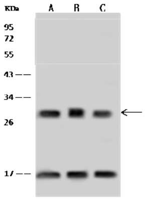 Western Blot: ASB9 Antibody [NBP2-98662]