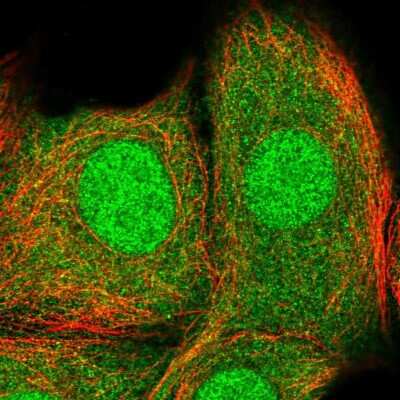 Immunocytochemistry/ Immunofluorescence: ASC/TMS1 Antibody [NBP2-48925]