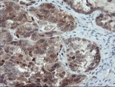 Immunohistochemistry: ASC/TMS1 Antibody (OTI3E9) - Azide and BSA Free [NBP2-71853]