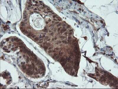 Immunohistochemistry: ASC/TMS1 Antibody (OTI3E9) - Azide and BSA Free [NBP2-71853]