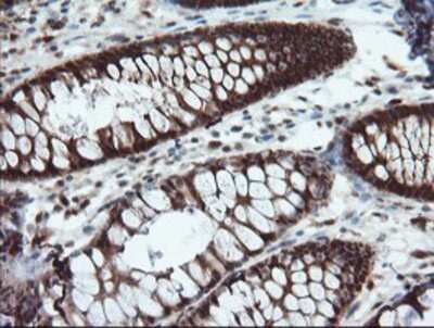 Immunohistochemistry: ASC/TMS1 Antibody (OTI3E9) - Azide and BSA Free [NBP2-71853]