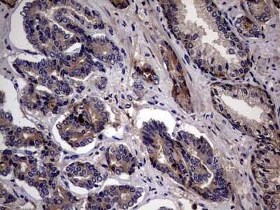 Immunohistochemistry: ASC2 Antibody (OTI9C10) [NBP2-45495]