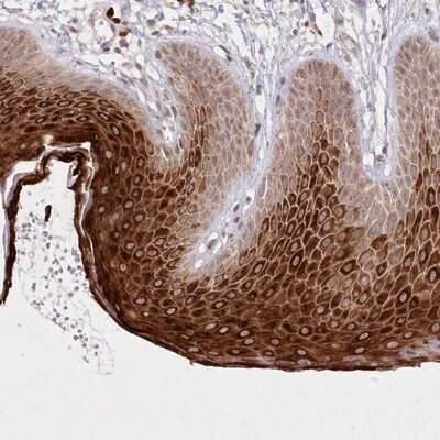 Immunohistochemistry-Paraffin: ASCC1 Antibody [NBP1-88855]