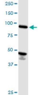Western Blot: ASCC2 Antibody (3B2) [H00084164-M07]