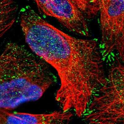 Immunocytochemistry/ Immunofluorescence: ASCC2 Antibody [NBP1-88815]