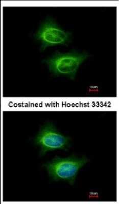 Immunocytochemistry/ Immunofluorescence: ASCC2 Antibody [NBP2-15487]
