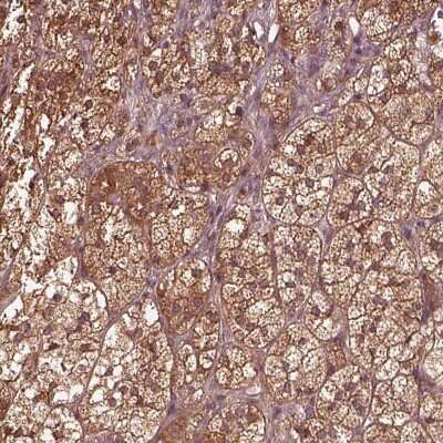 Immunohistochemistry: ASCC2 Antibody [NBP2-68704]