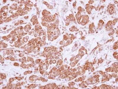 Immunohistochemistry-Paraffin: ASCC2 Antibody [NBP2-15487]