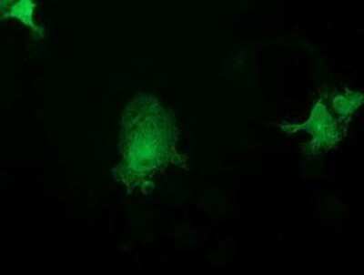 Immunocytochemistry/ Immunofluorescence: ASCC2 Antibody (OTI1E8) - Azide and BSA Free [NBP2-72273]