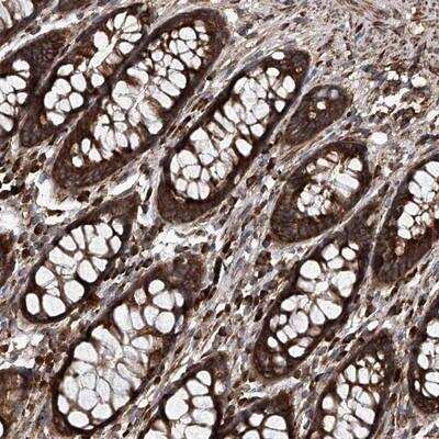 Immunohistochemistry: ASCC3 Antibody [NBP1-88853]
