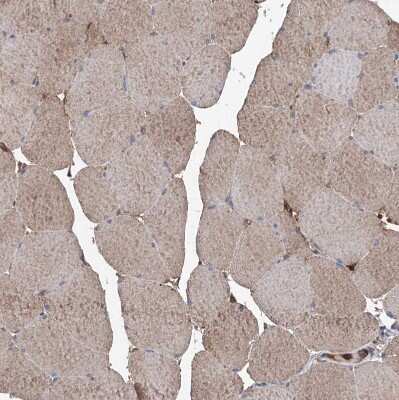 Immunohistochemistry-Paraffin: ASCC3 Antibody [NBP1-88829]