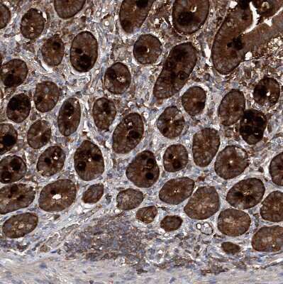 Immunohistochemistry-Paraffin: ASCC3 Antibody [NBP1-88829]