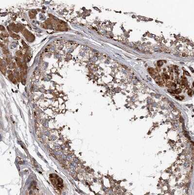 Immunohistochemistry-Paraffin: ASCC3 Antibody [NBP1-88829]