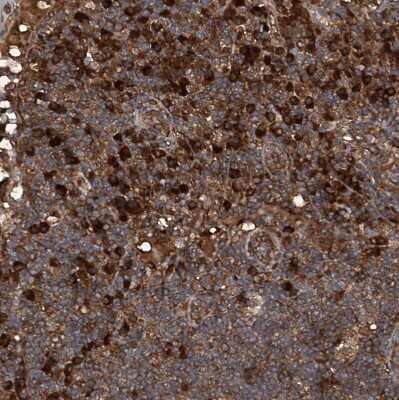 Immunohistochemistry-Paraffin: ASCC3 Antibody [NBP1-88829]