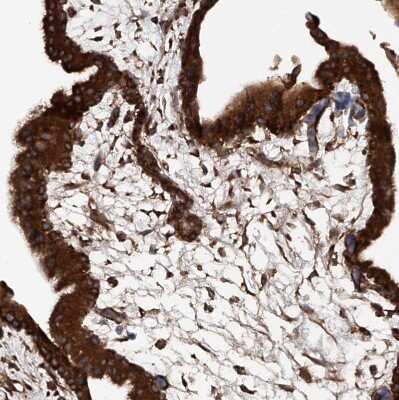 Immunohistochemistry-Paraffin: ASCC3 Antibody [NBP1-88829]