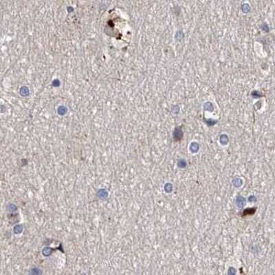 Immunohistochemistry-Paraffin: ASCC3 Antibody [NBP1-88829]