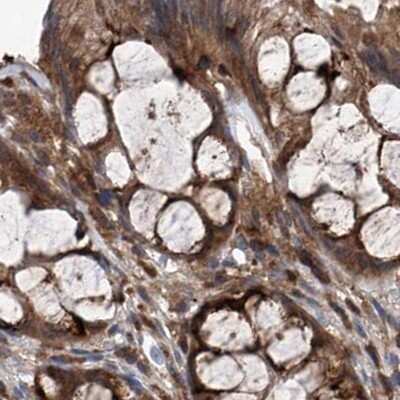 Immunohistochemistry-Paraffin: ASCC3 Antibody [NBP1-88829]