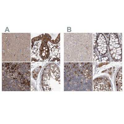 Immunohistochemistry-Paraffin: ASCC3 Antibody [NBP1-88853]