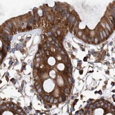 Immunohistochemistry-Paraffin: ASCC3 Antibody [NBP1-88853]