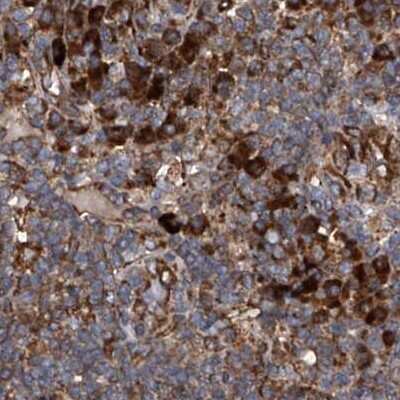Immunohistochemistry-Paraffin: ASCC3 Antibody [NBP1-88853]