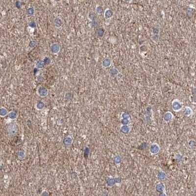 Immunohistochemistry-Paraffin: ASCC3 Antibody [NBP1-88853]