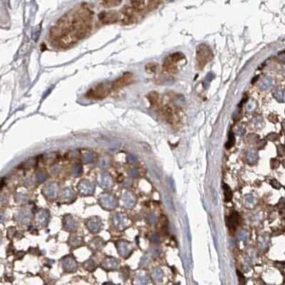 Immunohistochemistry-Paraffin: ASCC3 Antibody [NBP1-88854]