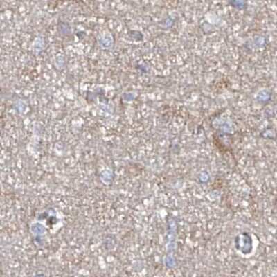 Immunohistochemistry-Paraffin: ASCC3 Antibody [NBP1-88854]